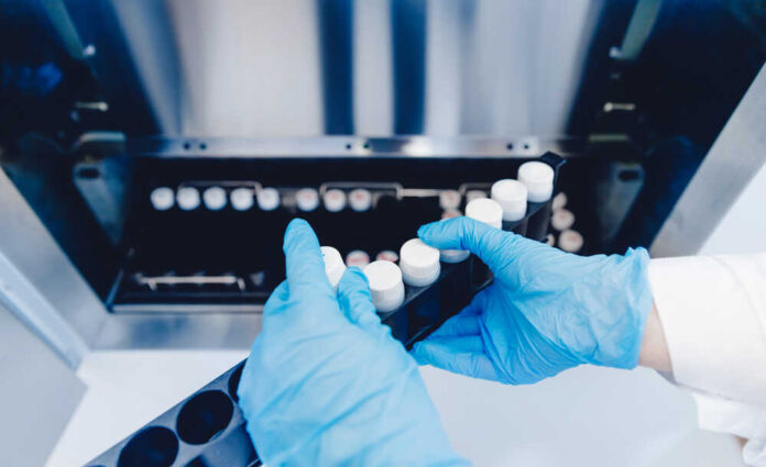 Person in blue gloves handling test tubes in a laboratory