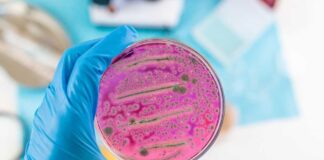 A hand holding a petri dish with pink bacterial growth