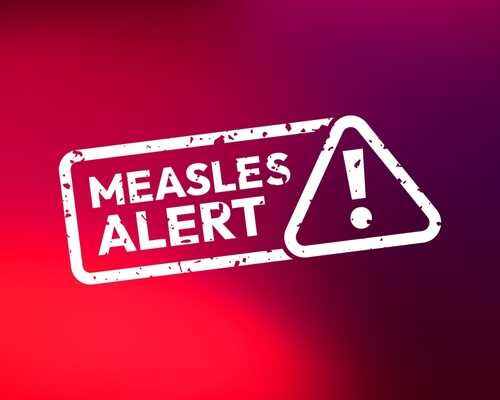 Measles alert warning sign with exclamation mark