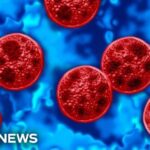 Michigan reports two deaths linked to cyclosporiasis outbreak