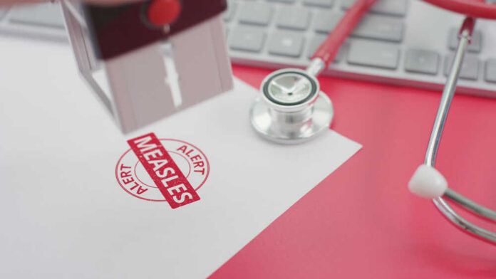 Putting,Measles,Alert,Stamp,On,The,Paper A stamp marking 'MEASLES ALERT' on a piece of paper next to a stethoscope and keyboard