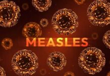 Vaccine Chaos – Measles Explosion Illustration of measles virus particles with the word 'MEASLES' in bold